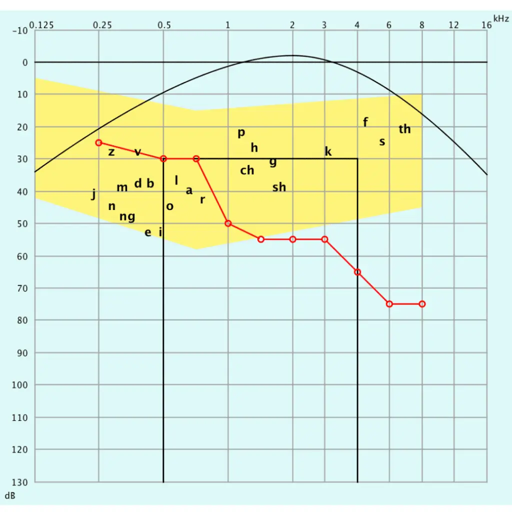 Schütt Optik Hörakustik Ludwigsburg Audiogramm
