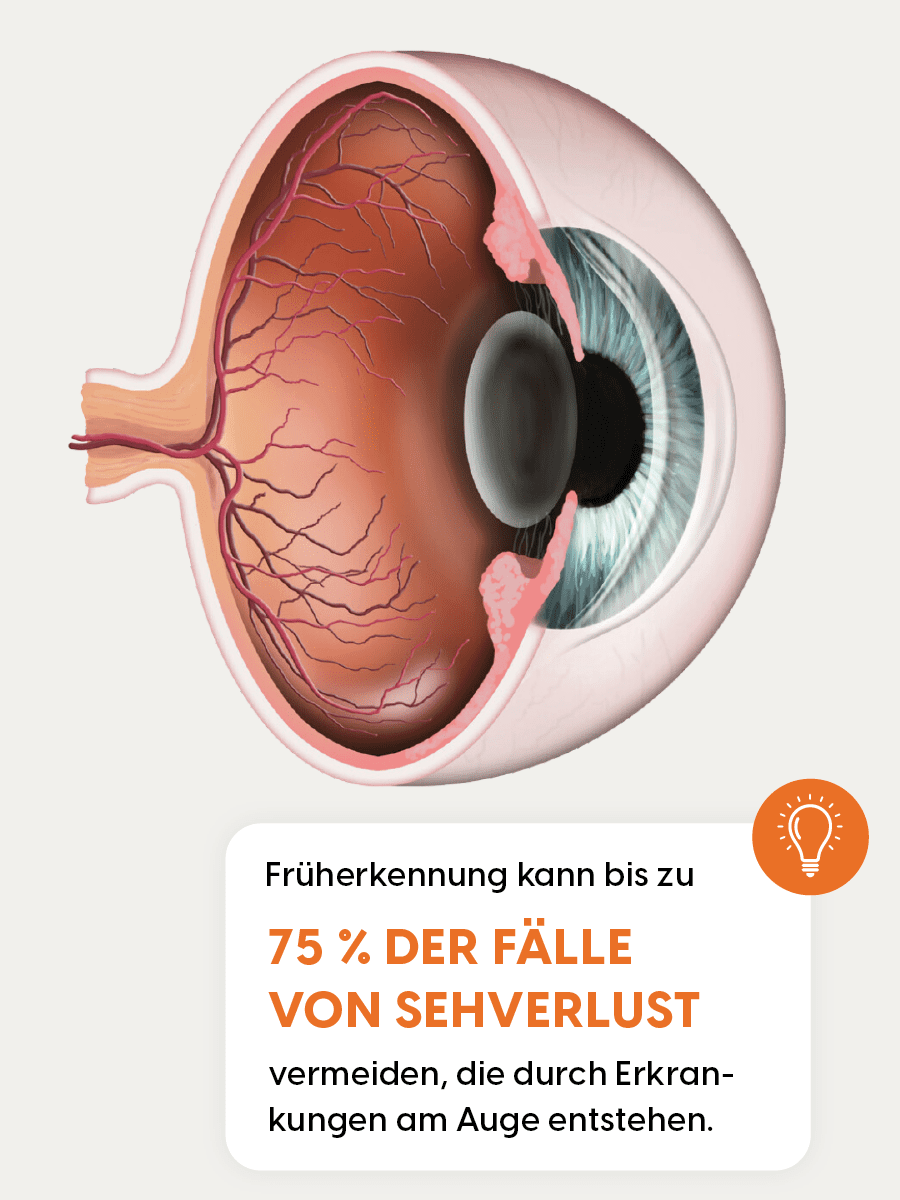 Schütt Optik Hörakustik Ludwigsburg Netzhautanalyse mit KI Auswertung Früherkennung