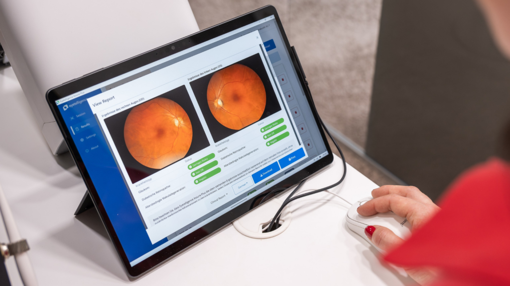 schütt optik hörakustik ludwigsburg augen und hoergesundheit netzhautanalyse