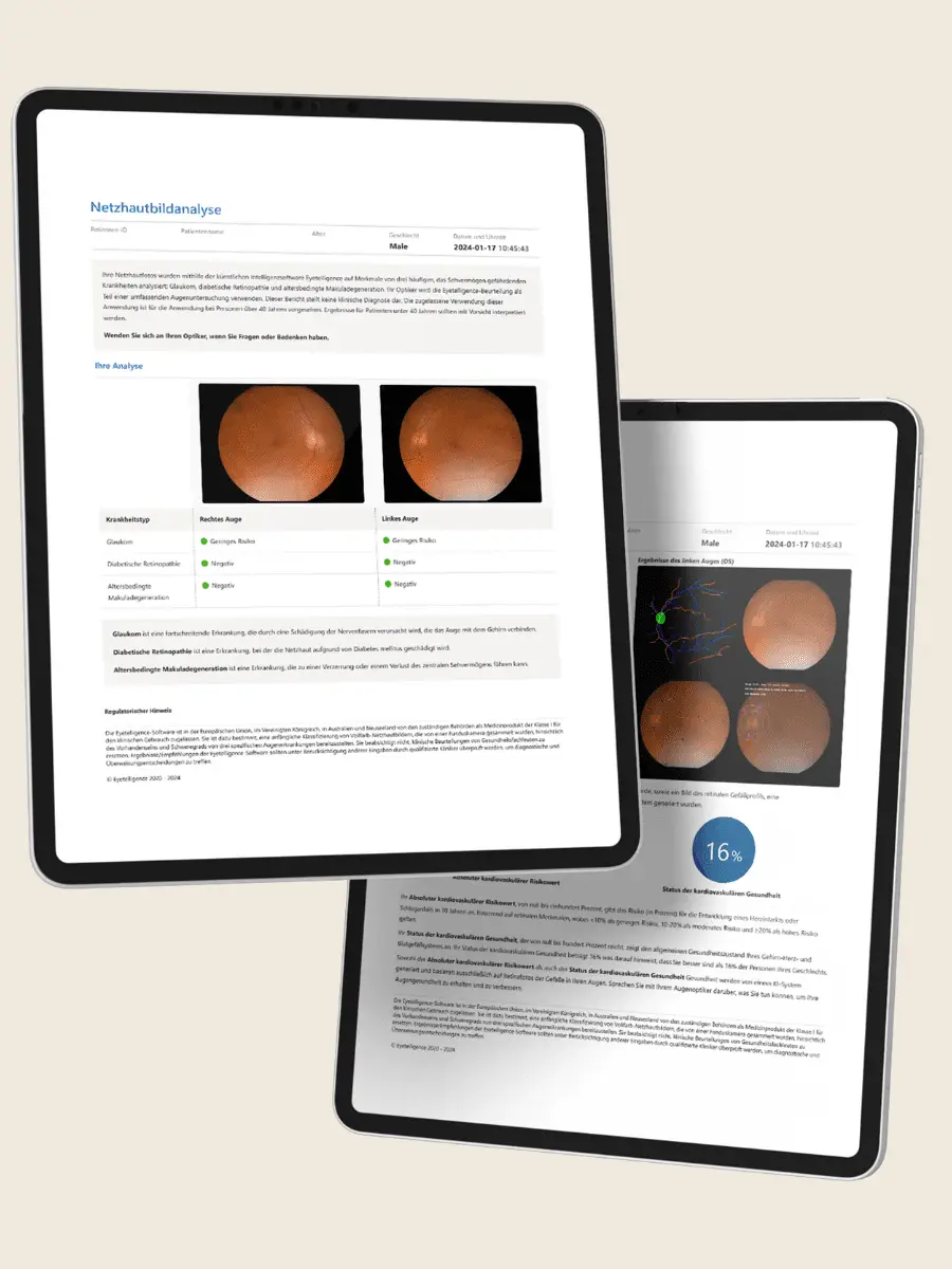 Schütt Optik Hörakustik Ludwigsburg Netzhautbildanalyse