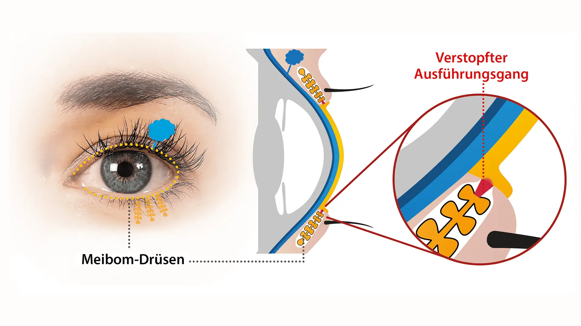 Meibom Drüsen Erklärung von SCHÜTT Optometrist in Ludwigsburg