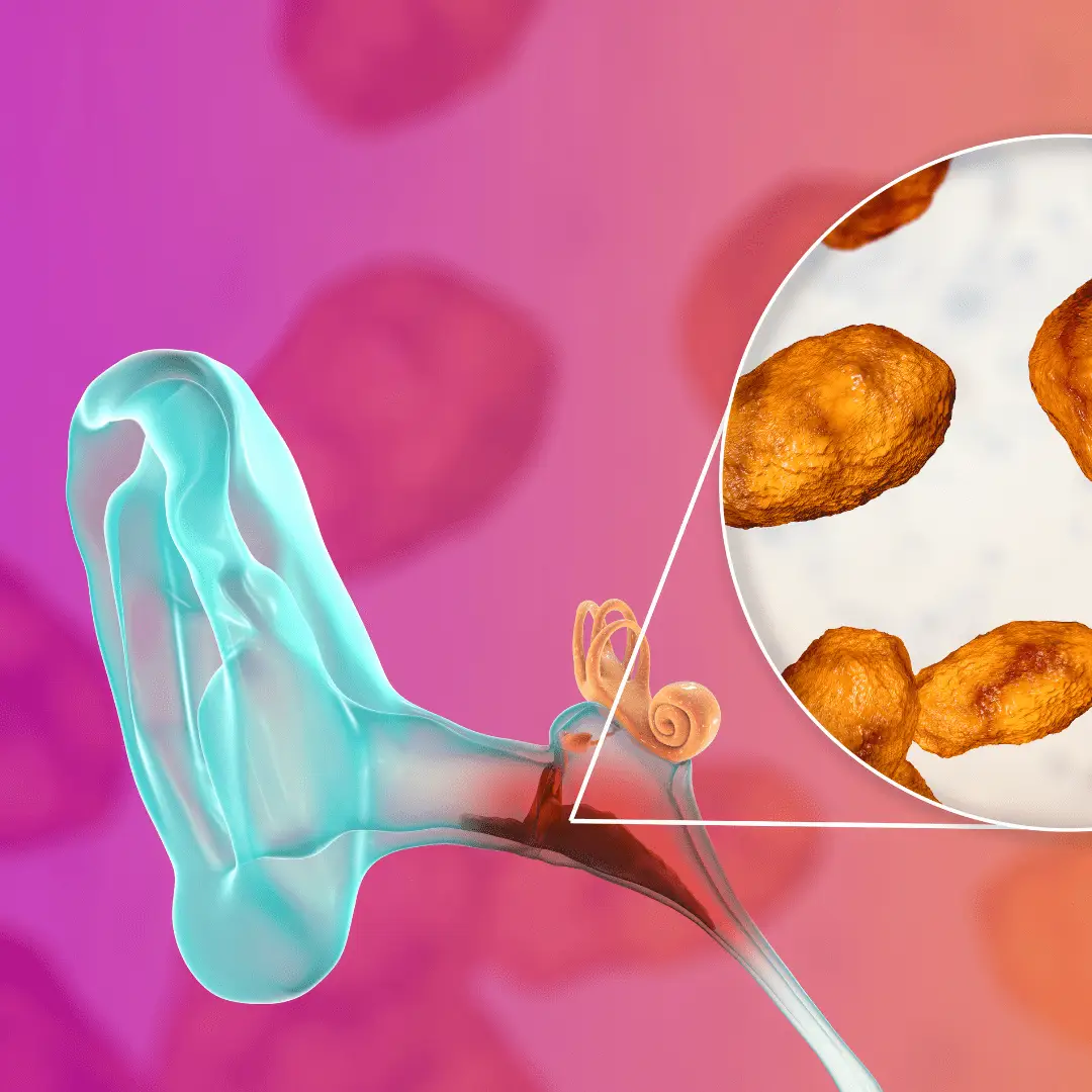 Schütt Optik Hörakustik Ludwigsburg Trommelfell Otoskopie Schütt